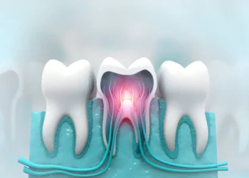Kill Tooth Pain Nerve in 3 Seconds Permanently