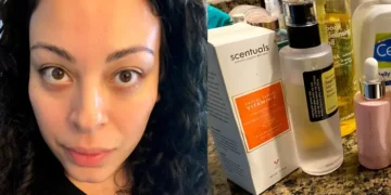 Skincare routine for hormonal acne