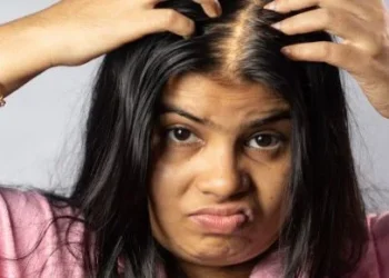 how to prevent hair loss in women naturally