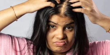how to prevent hair loss in women naturally
