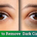 how to reduce dark circles under eyes permanently