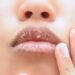 Lip care tips for cracked lips in winter