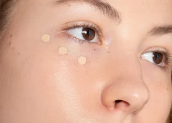Best concealers for covering hormonal acne