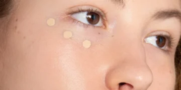 Best concealers for covering hormonal acne