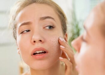 natural remedies for dry flaky skin on face