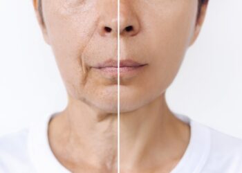 how to prevent wrinkles in your 30s naturally